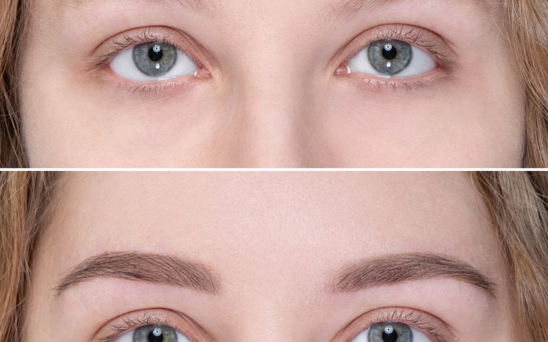 The first results are in from our NEW eyebrow treatment